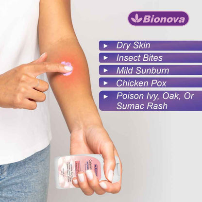 Novacalamine Calamine Lotion - 100 ml